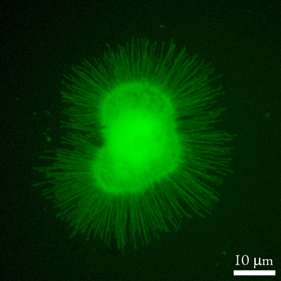 Neurônio em microscopia de fluorescência, com seus prolongamentos